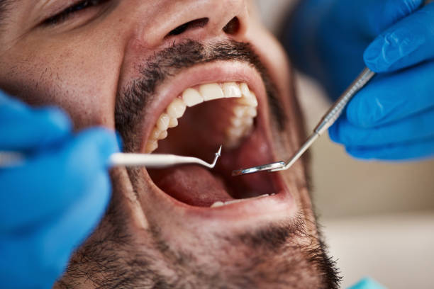 Emergency Dental Services in Winona, MS